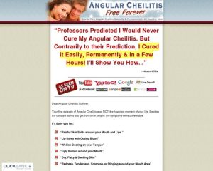 angularche-x400-thumb.jpg