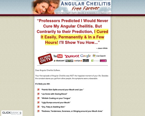 angularche-x400-thumb.jpg