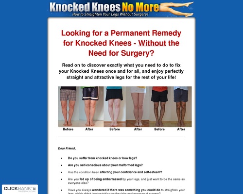 knocklegs-x400-thumb.jpg